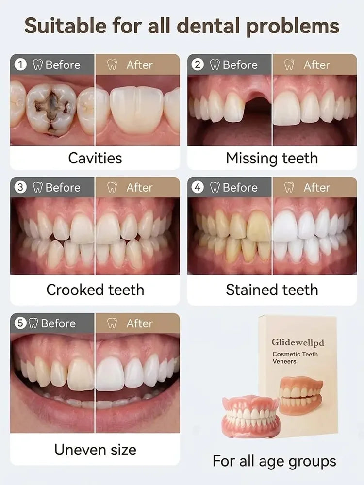 🔥 Custom-Fit Instant Smile Dentures™ – Natural Look & Comfort Fit | 50% OFF Today